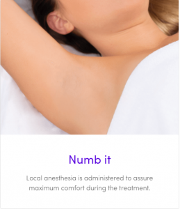 miradry infographic - numb it - local anesthesia is administered to assure maximum comfort during the treatment