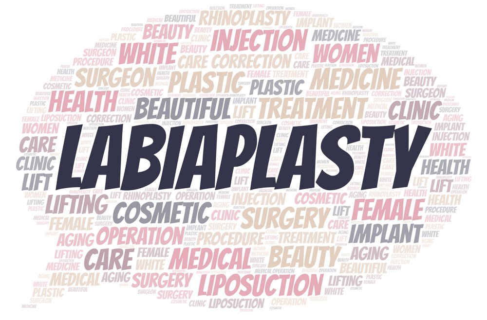 Labiaplasty infographic